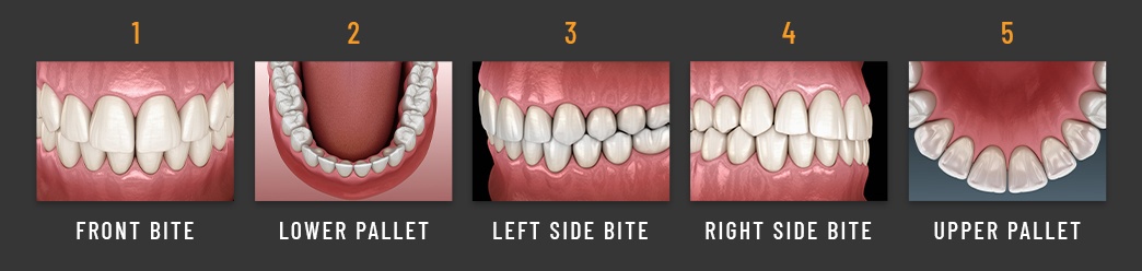 5 different angles of teeth